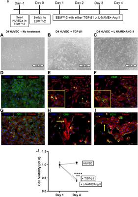 An In Vitro Platform to Study Reversible <mark class="highlighted">Endothelial-to-Mesenchymal Transition</mark>